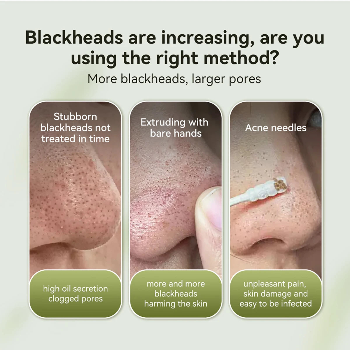 Lanbena Blackhead Remover mask
