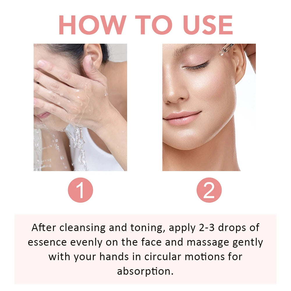 30ml Niacinamide Face Serum