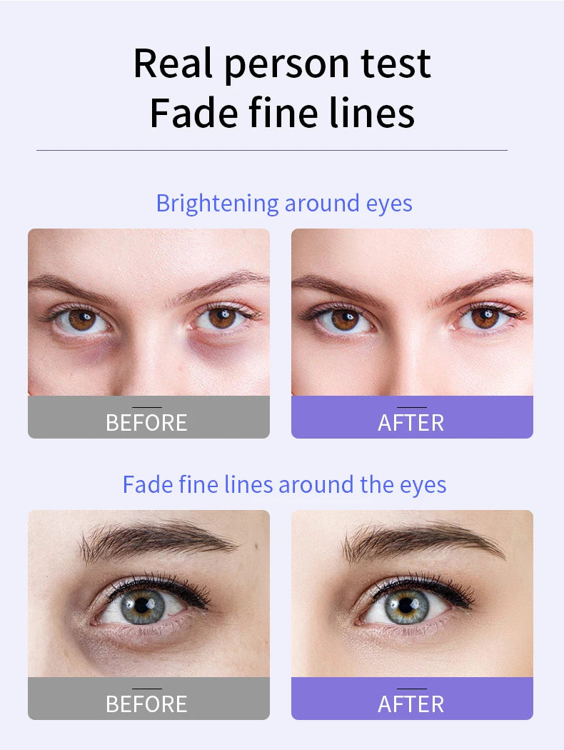 Anti-Wrinkle Eye Cream with Roller Ball