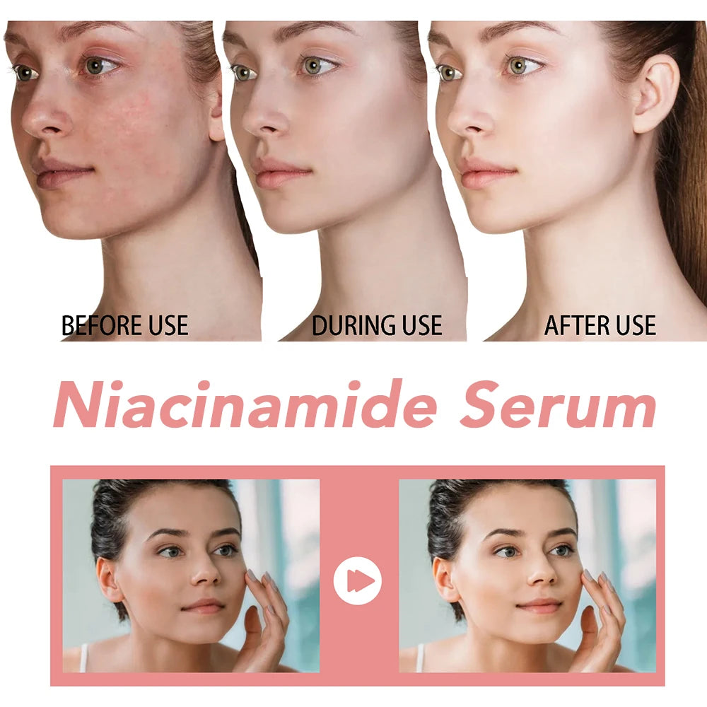 30ml Niacinamide Face Serum