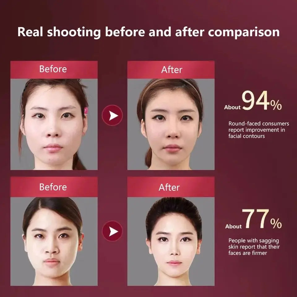 LED Photon Therapy V‑Face Massager