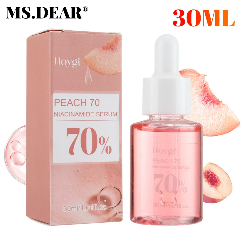 30ml Niacinamide Face Serum