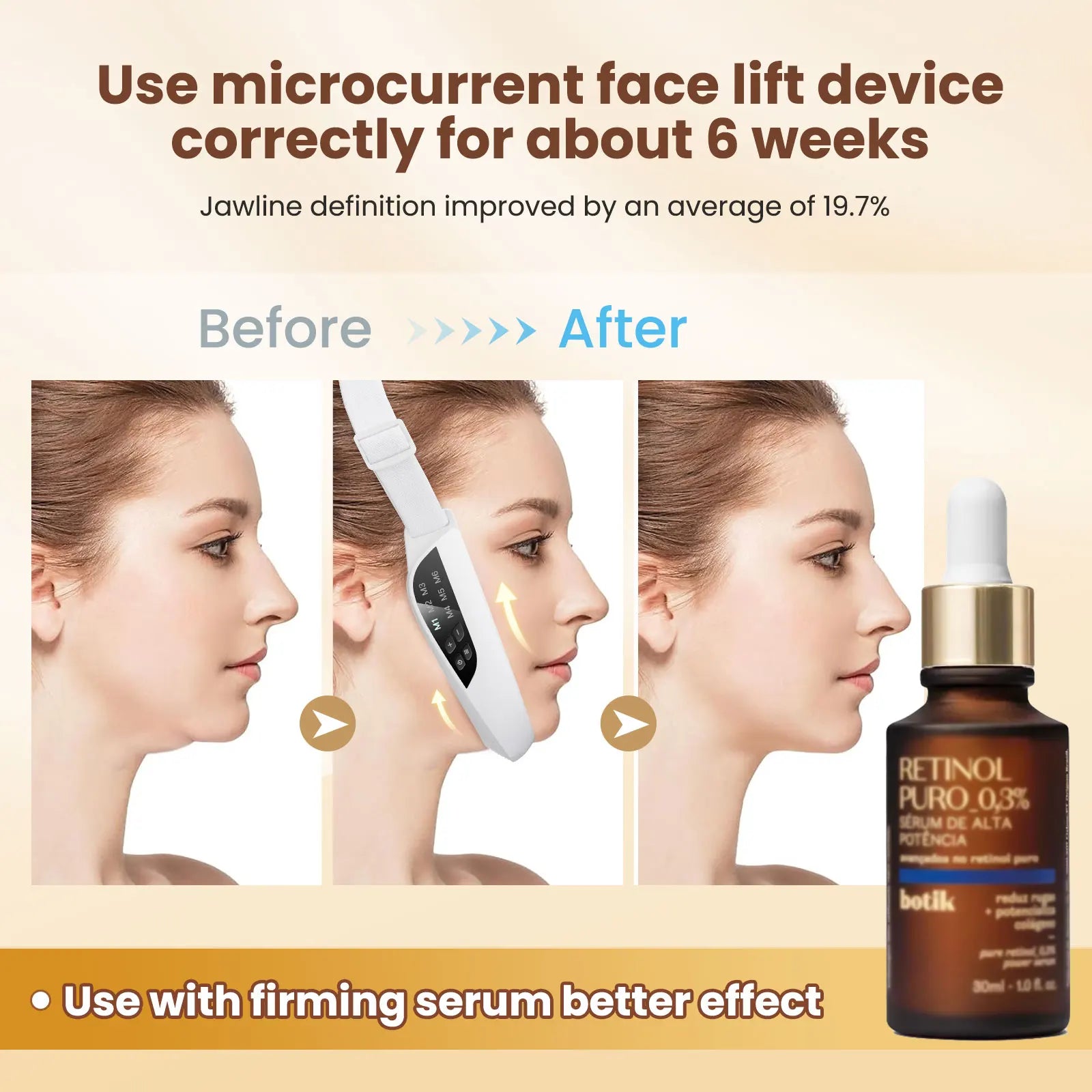 V-Shaped Face Lifting Device