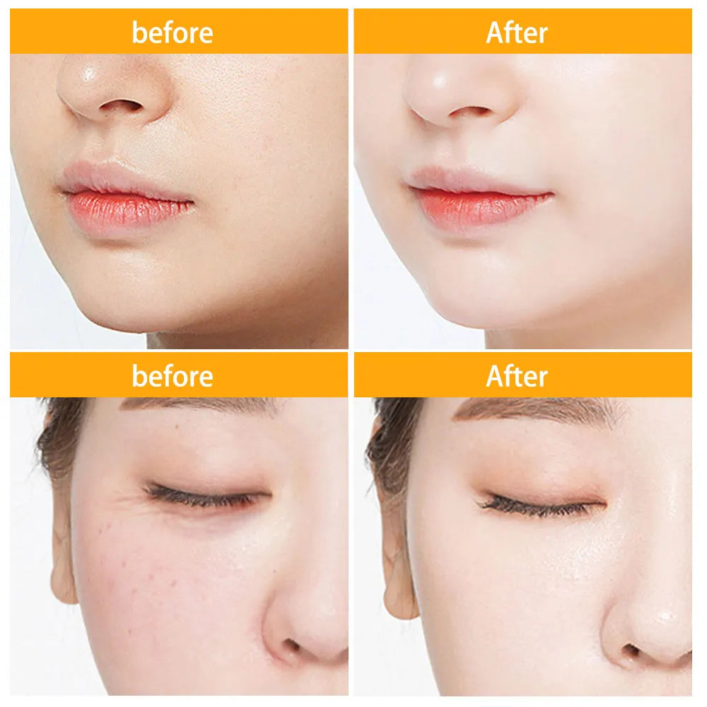Ms.Dear Hyaluronic Acid Capsules Serum